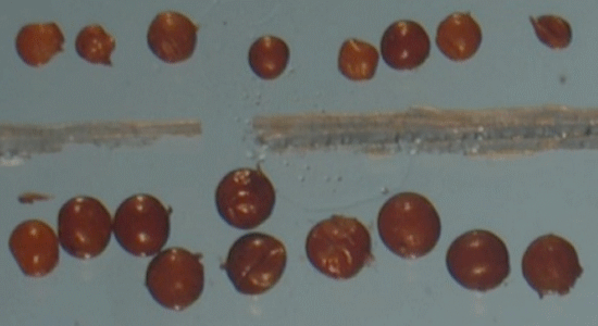 Cysts caused by potato cyst nematodes