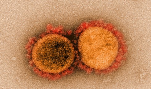 MERS-CoV Photos | CDC