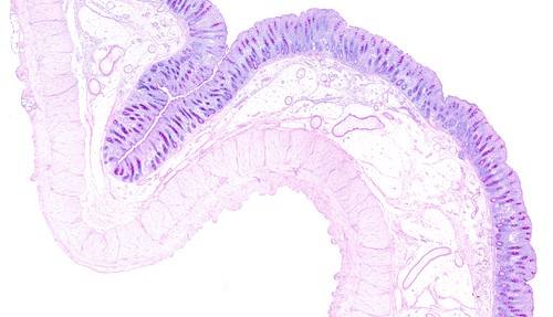 Ed Lavelle intestine M