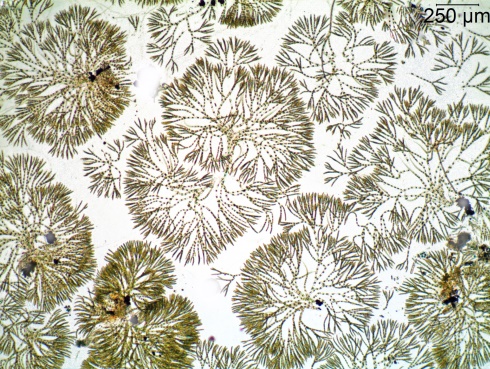 Algae Chaetophora Fens